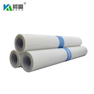 17&quot; film d'impression laser de toner d'ANIMAL FAMILIER du laser X Ray Film Rolls de blanc de X30m