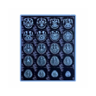 Film médical de jet d'encre d'animal familier de pouce du bleu imprimable X Ray Film 11x14 de la CE