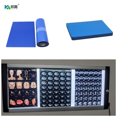 Le film 8x10 13x17 14x17 A4 A3 100 du jet d'encre X Ray Medical Blue Base Dry de 210 microns couvre