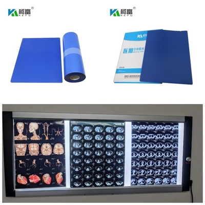 L'encre basse bleue médicale 14inch X de colorant du jet d'encre X Ray Film DR CT IRM 125 feuilles roulent 10x12