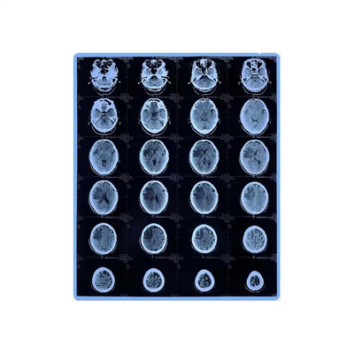 Film jet d'encre bleu pour l'impression graphique aux rayons X médicaux