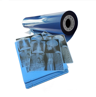 Jet d'encre de film médical bleu pour des résultats d'imagerie par rayons X cohérents