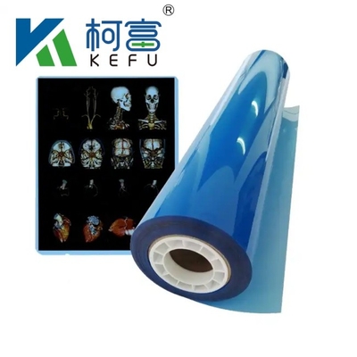 Film de radiographie médicale d'usine bleu film de radiographie médicale sensible