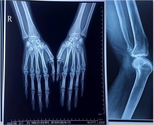 195 film bleu impression du laser X Ray Film A3 A4 Digital d'ANIMAL FAMILIER de micron