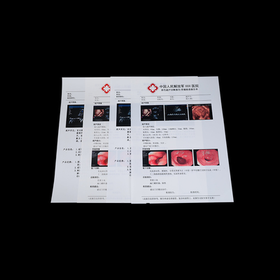 125 microns d'impression laser de film sec médical semi transparent du film A3 A4 A5