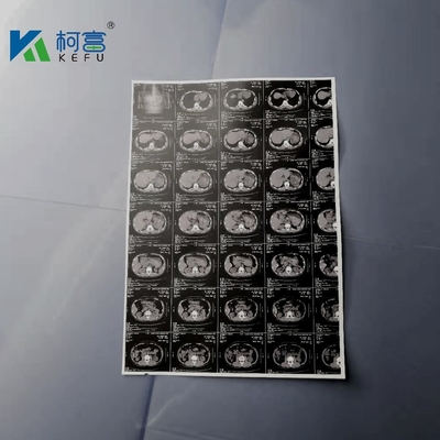 imprimante médicale Film du jet d'encre blanc X Ray Film Canon Epson Inkjet de 180um A3