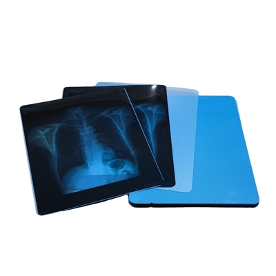 laser de 35x43cm X Ray Thermal Imaging Film Compatible avec Fuji 3500 Fuji 7000