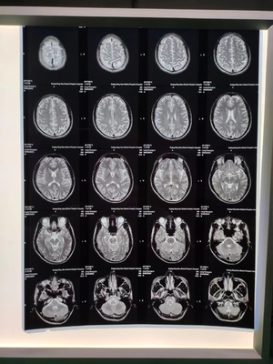 210 microns de jet d'encre X Ray Film A3