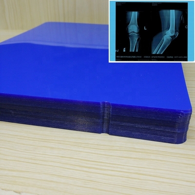 Film sec médical Digital X Ray Film de bas pouce du brouillard 13x17 330mmx432mm