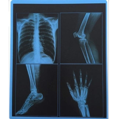 195 microns CHOIENT l'imprimante bleue du laser X Ray Film For Fuji OKI de pouce de X Ray Film 10x12