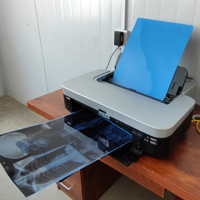 35x43CM Film bleu de rayons X médical pour les modalités d'imagerie par IRM
