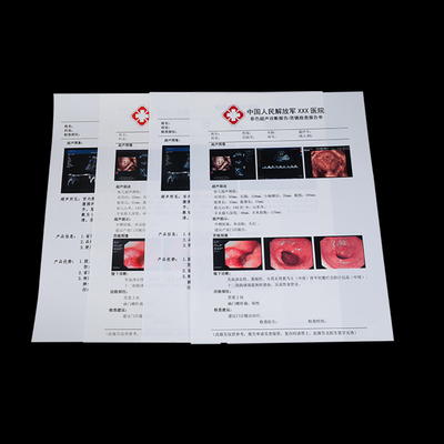180 microns non-toxiques de sortie médicale de X Ray Film For Ultrasound Report