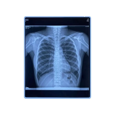 Film médical de jet d'encre d'animal familier de pouce du bleu imprimable X Ray Film 11x14 de la CE