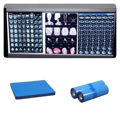 210microns base blanche basse bleue du jet d'encre X Ray Films For DR de pouce médical du CR 8x10