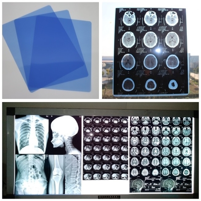 210um cassette médicale du jet d'encre X Ray Film Blue For Digital DR CT IRM avec les feuilles 8x10