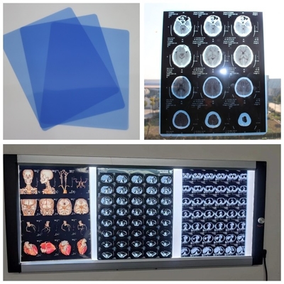 Film sec de jet d'encre médical bas bleu pour Digital X Ray Image With 210microns A3 13x17