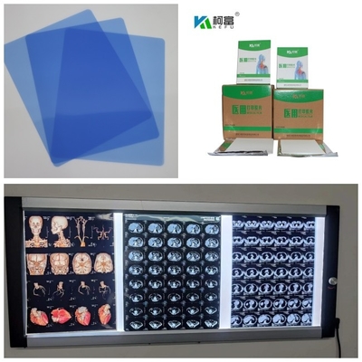 Jet d'encre médical X Ray Film Blue Base With 280gsm de Digital pour 14x17inch A4 imperméable