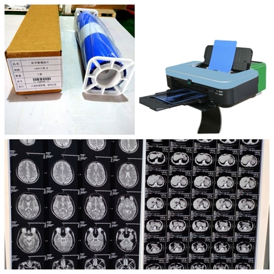 Films médicaux à rayons X à coût raisonnable et à haute stabilité d'image