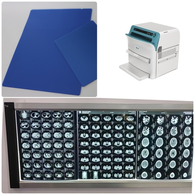 Processus d'impression thermique Film sec médical à surface lisse et à haute imprimable