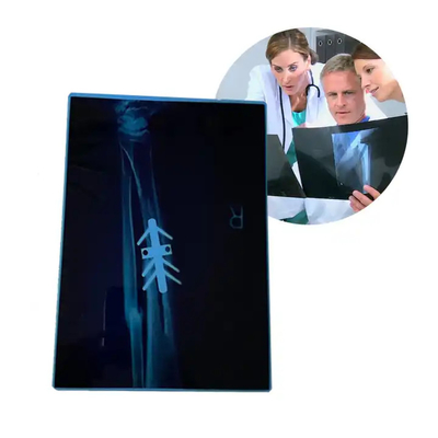 Imprimante thermique médicale à sec Imprimante à jet d'encre bleue A4 PET équipement médical orthopédique Rayons X