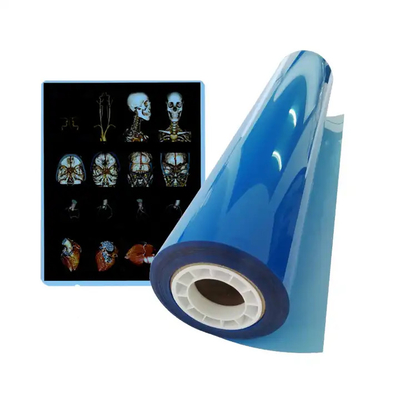 Imprimante thermique médicale à sec Imprimante à jet d'encre bleue A4 PET équipement médical orthopédique Rayons X