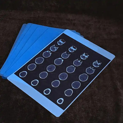 Imprimante thermique médicale à sec Imprimante à jet d'encre bleue A4 PET équipement médical orthopédique Rayons X