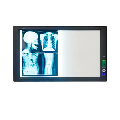 Film bleu de rayons X médical pour imprimantes à jet d'encre à haute netteté et faible brouillard