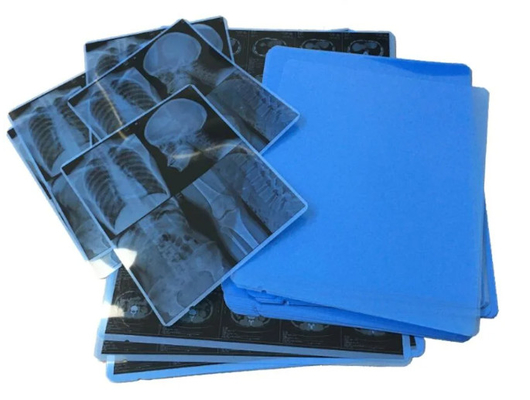 Film bleu médical à rayons X pour imprimantes à jet d'encre et images claires et précises
