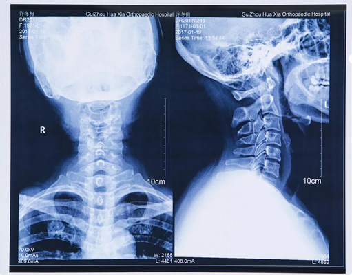 Le laser bleu est un film de radiographie médicale séchée et sexy.