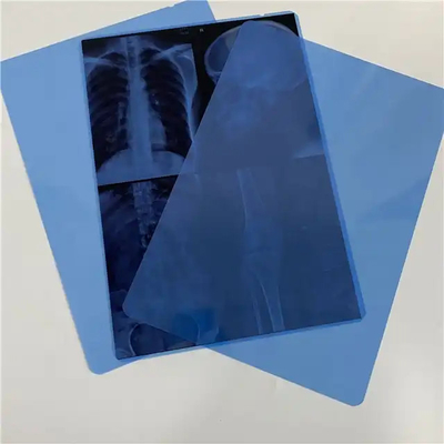 Imprimable à jet d'encre PET Laser sec Film à rayons X Base bleue transparente pour l'imagerie diagnostique