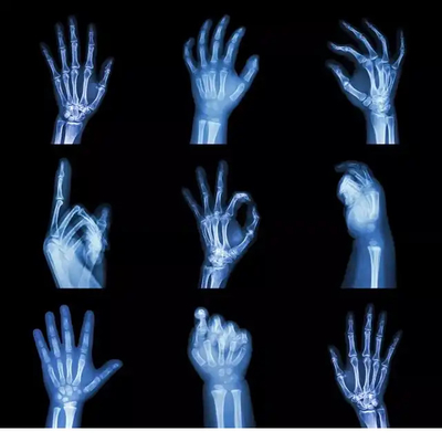 Imprimable à jet d'encre PET Laser sec Film à rayons X Base bleue transparente pour l'imagerie diagnostique