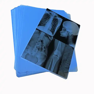 Images médicales à jet d'encre thermique à rayons X à base de PET bleu pour les hôpitaux cliniques