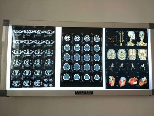 Imagerie par film sec imperméable aux rayons X pour appareils médicaux Impression laser à jet d'encre