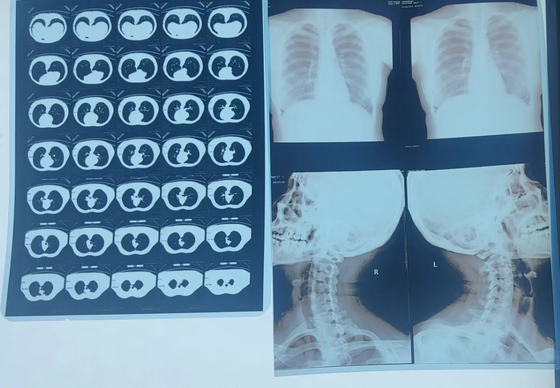 Système d'imagerie médicale Film sec laser à rayons X pour DR CR IRM X - Imprimante à rayons X avec ISO CE