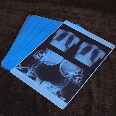 Imprimés à jet d'encre pour l'imagerie médicale avec un film bleu de rayons X médical