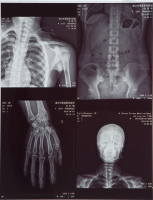 Film laser pour l'impression d'images médicales à rayons X