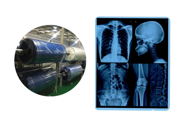 Films médicaux à rayons X rouleaux jet d'encre Base bleue pour CR DR CT IRM sortie d'image