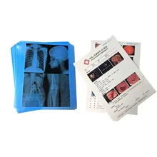 Compatibilité Imprimantes à jet d'encre Canon / Epson Film à jet d'encre à rayons X 210 microns Épaisseur du film bleu
