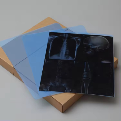 Le film de rayons X Fuji DIHL X Ray médical de l'imagerie laser à sec