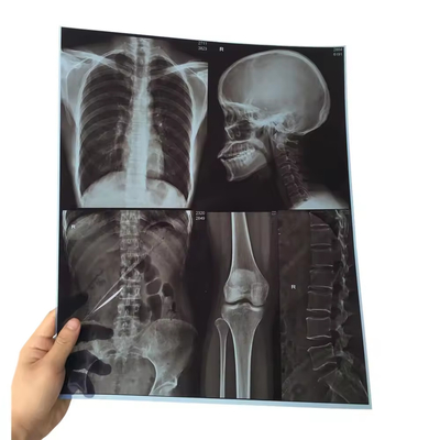 Le film de rayons X Fuji DIHL X Ray médical de l'imagerie laser à sec