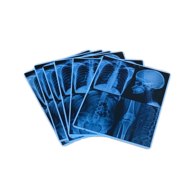 Stabilité d'image élevée Film médical bleu jet d'encre pour film à rayons X