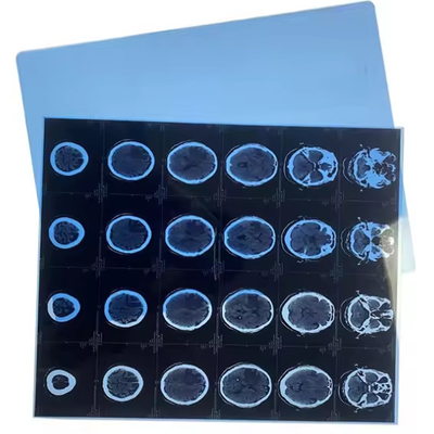 Imprimés à jet d'encre pour l'imagerie médicale avec un film bleu de rayons X médical