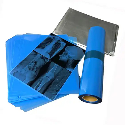 Imprimés à jet d'encre pour l'imagerie médicale avec un film bleu de rayons X médical