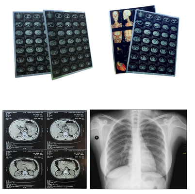 Fichiers de taille A4 Film médical jet d'encre bleu pour l' image médicale