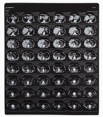 Excellente souplesse du film de rayons X médical pour le processeur d'imprimante laser