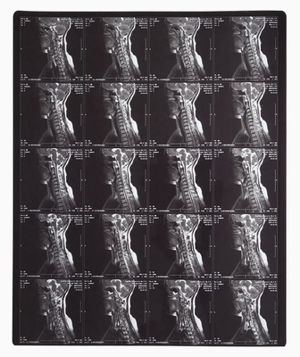 Film laser bleu d'imagerie radiologique pour imprimante thermique d'images laser