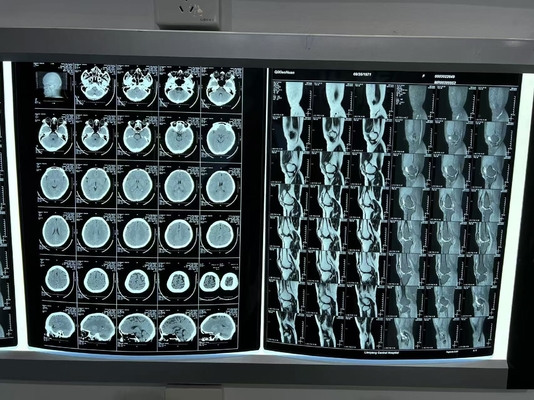Film d'impression thermique laser X bleu pour l'imagerie radiologique unique