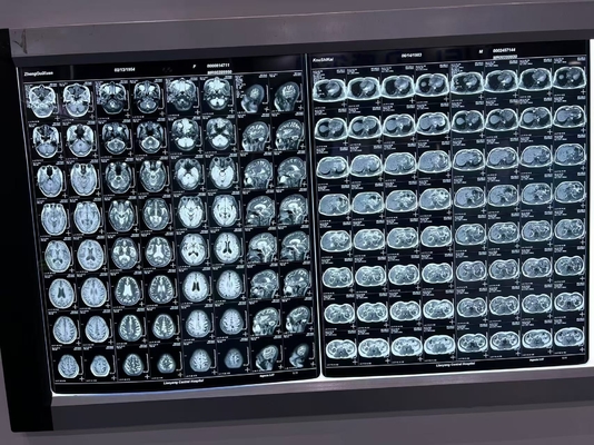 Film à rayons X à densité automatique pour équipement médical