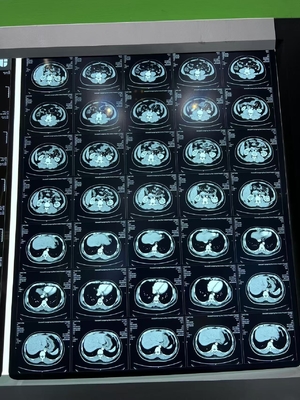 Film d'impression thermique pour les équipements médicaux à rayons X