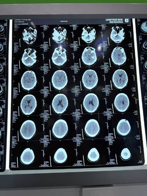 3.0D Contraste supérieure de la flexibilité du film laser sec aux rayons X pour les soins médicaux